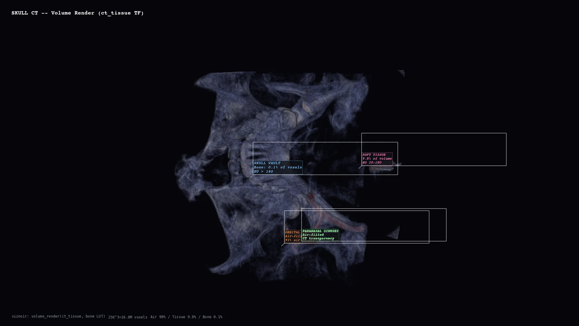 Medical CT volume rendering